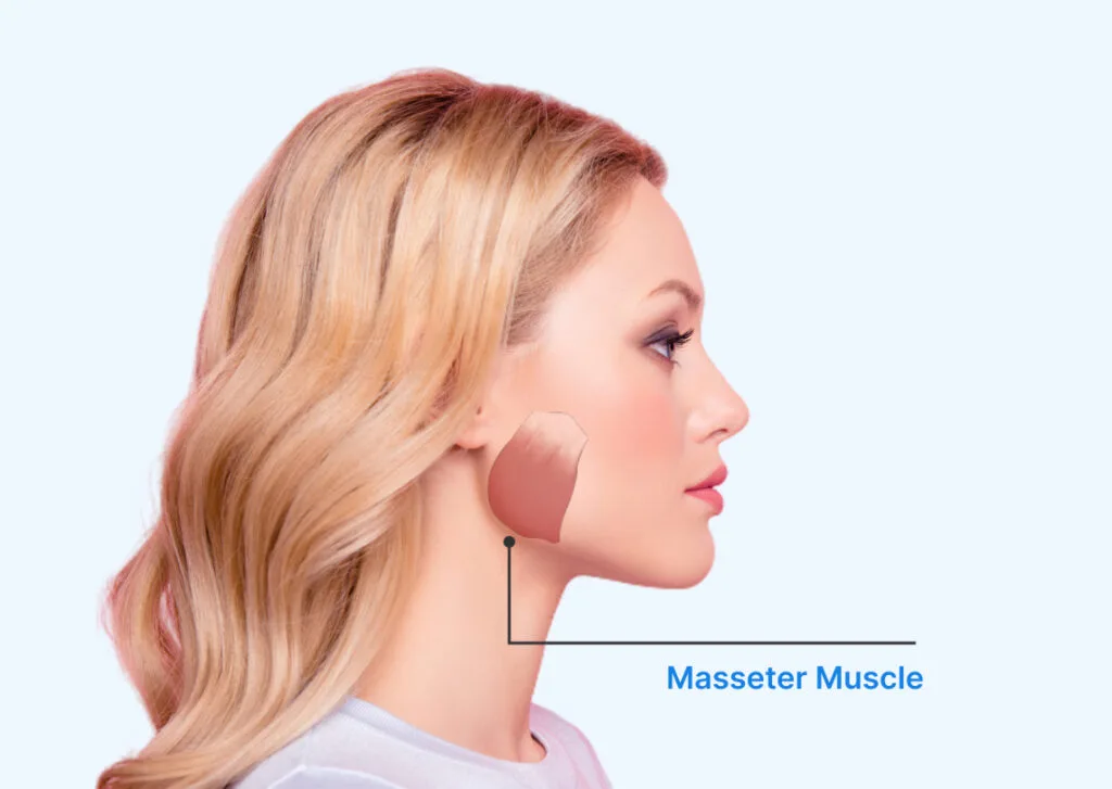 Botox Treatment At Best Injector