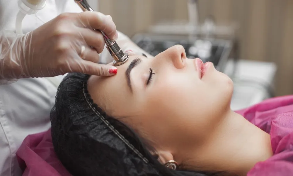 How Many Microneedling Sessions Are Needed For Optimal Results