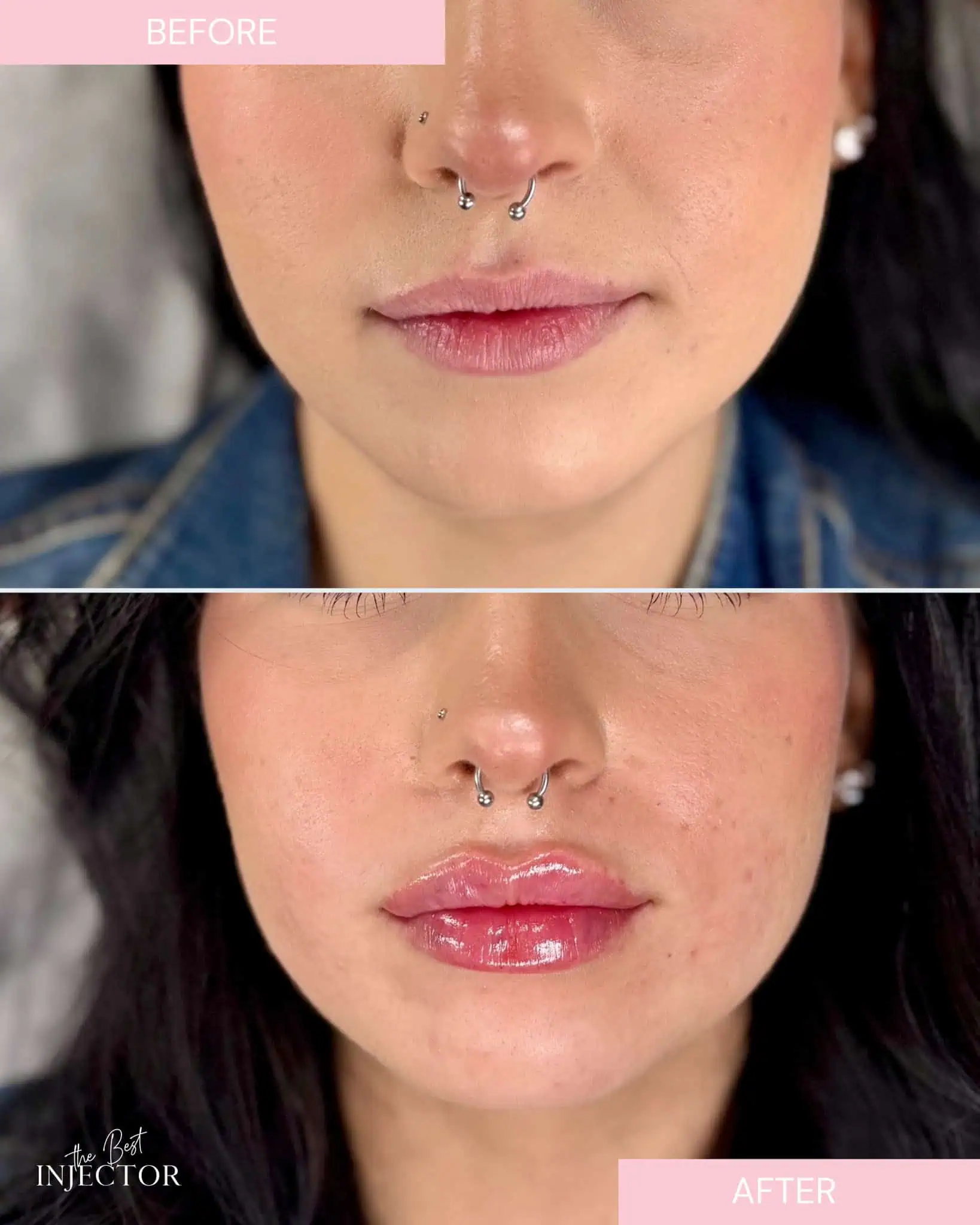 Julie-Horne-Technique-for-Lips-in-Delray-Beach-2.webp