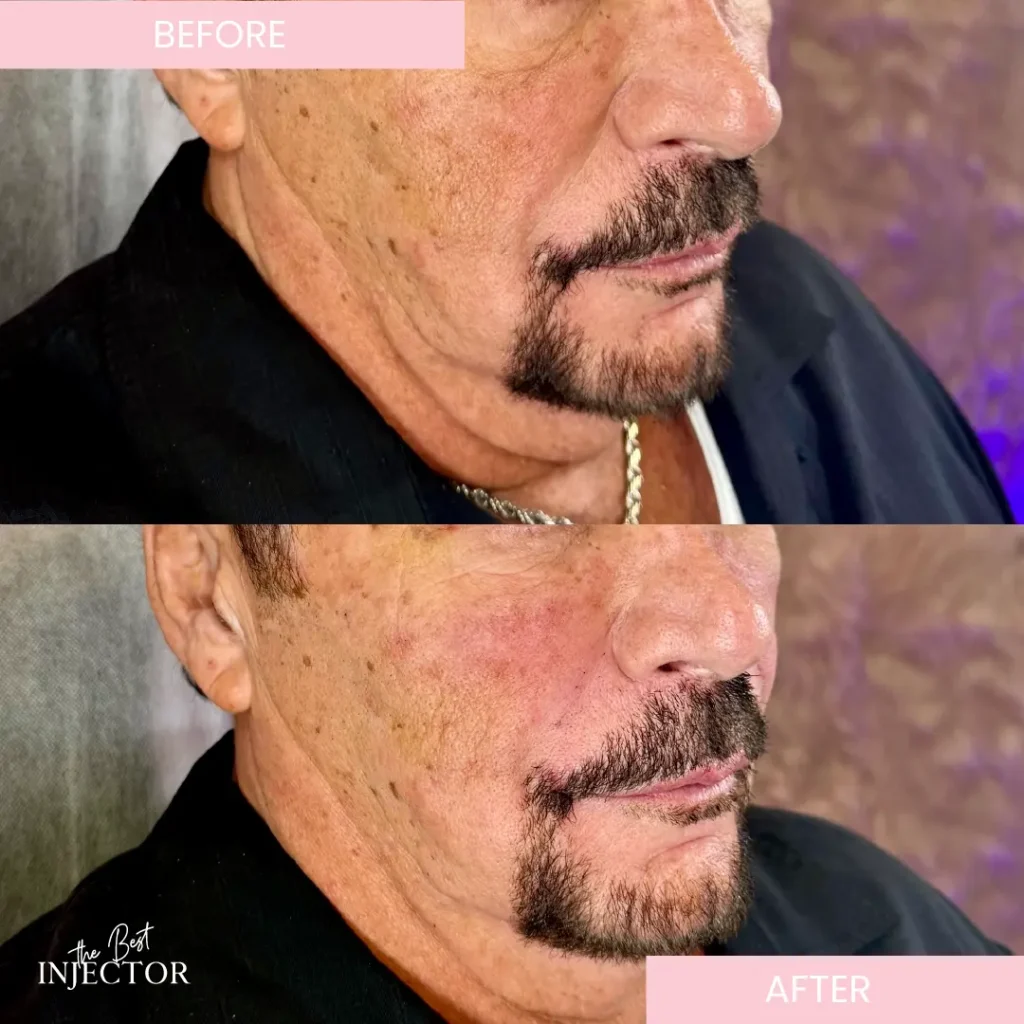 Before after (1) (1)