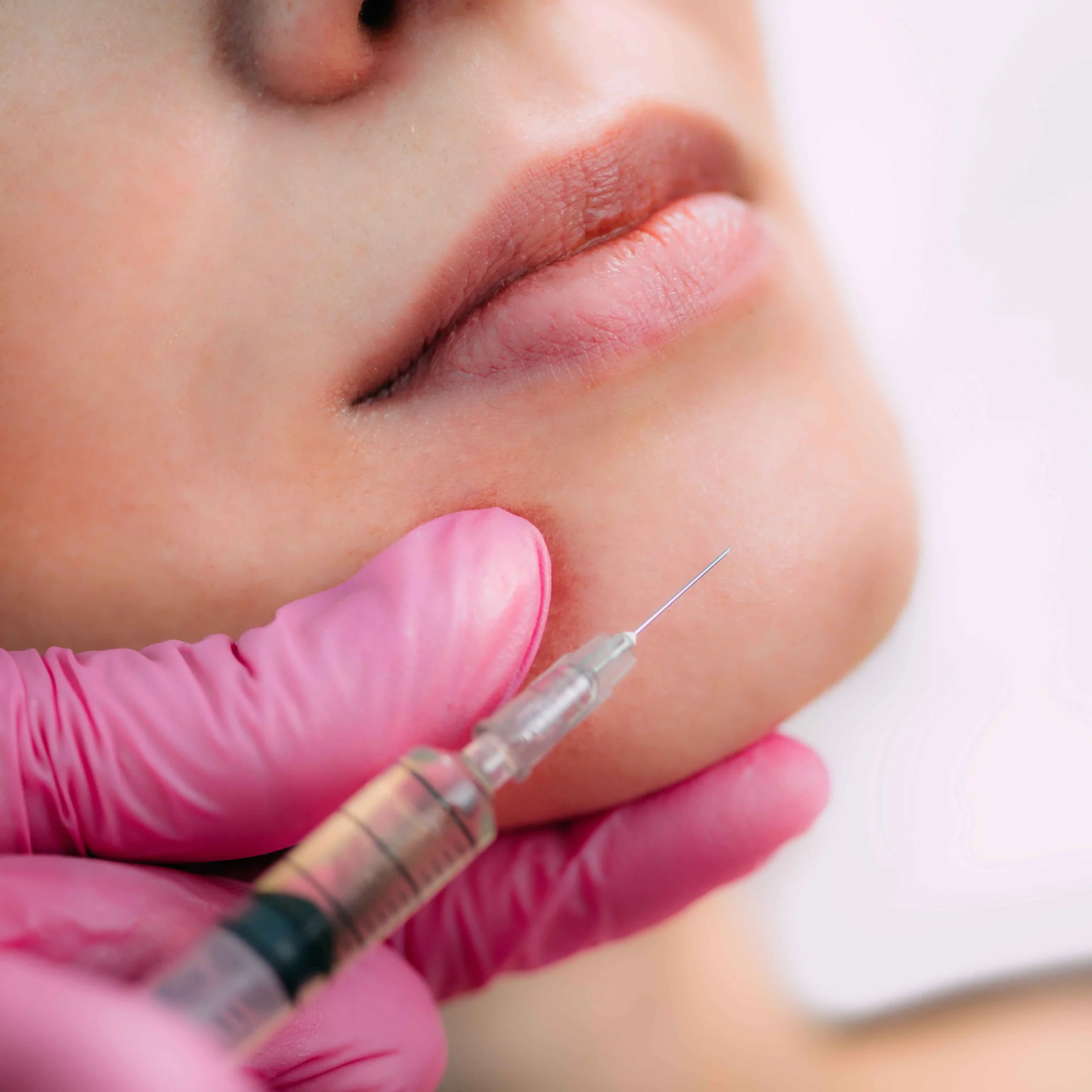 Chin Filler Treatment