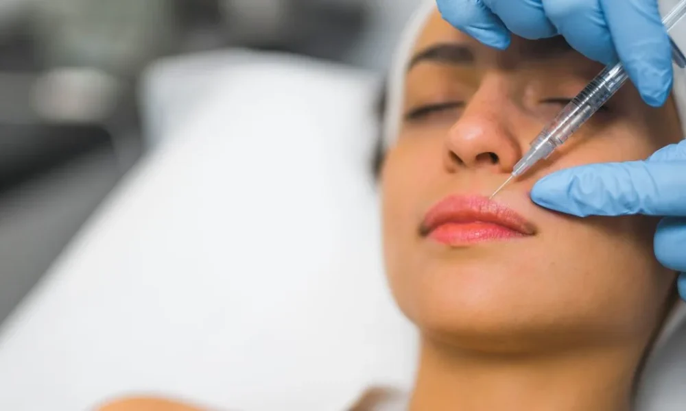 Aesthetic injector administering a hyaluronic acid dermal filler injection to a woman's lower lip area for subtle, natural enhancement.