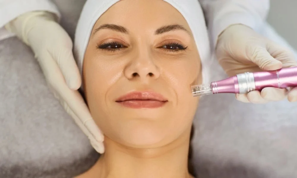 WomenreceivingMicroneedlinginDelrayBeachFL at The Best Injector